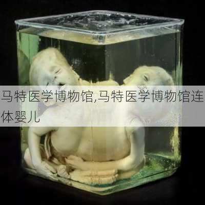 马特医学博物馆,马特医学博物馆连体婴儿